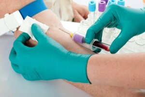 Symptoms and Causes of Hyperpotassemia