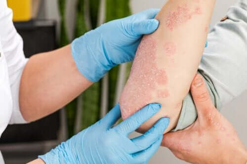 Types of Skin Rash and Their Causes