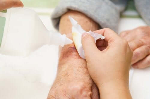 Caring for Bedsores and Preventive Measures