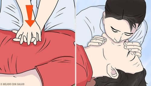 Kälteschock - Illustration einer Herzdruckmassage zur Wiederbelebung