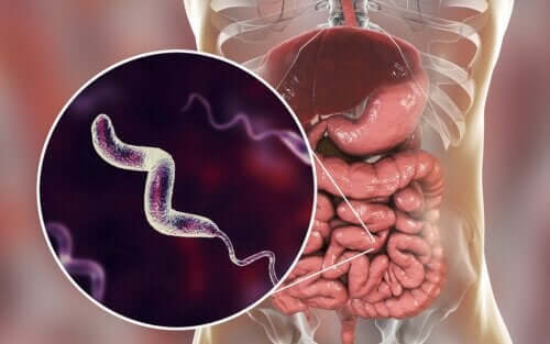 Characteristics of Campylobacter Infections