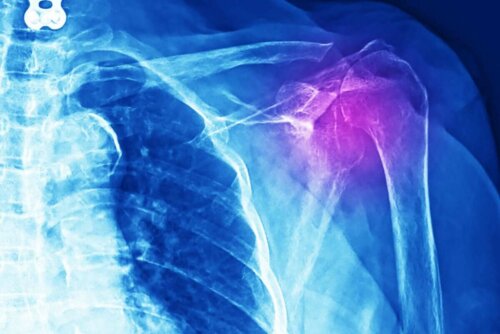 An x-ray of a person.