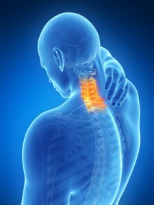 Cervicalgia: What Is It and What Causes It?