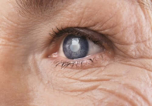 What Is Diabetic Retinopathy?