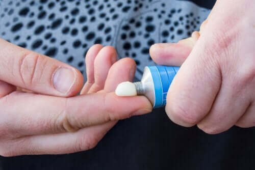 Diproderm cream.