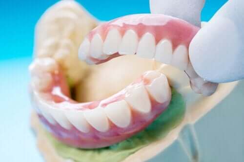 Dental Bridge: Types, Benefits, and Disadvantages