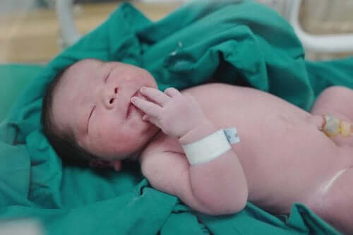 Neonatal Abstinence Syndrome