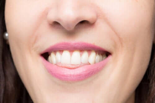 What is an Open Bite and How is It Corrected?
