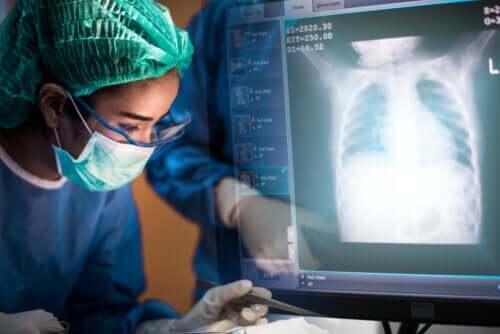Lung Transplant: Everything You Need to Know