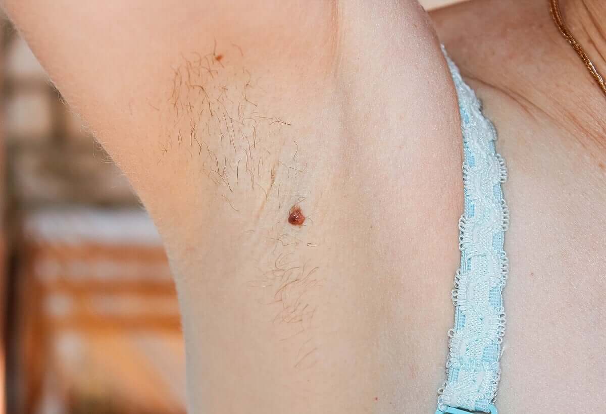 A woman with underarm hair.