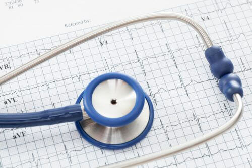 Types of antiarrhythmics.