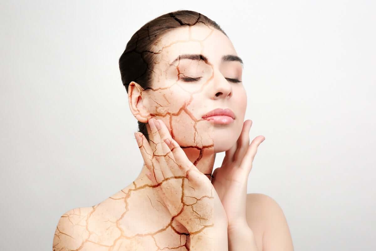 Woman with dry skin touches her face.