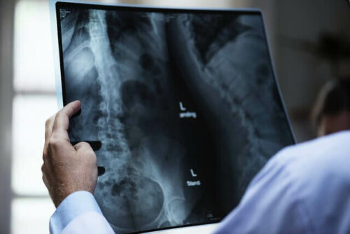 A doctor reviewing an X-ray.