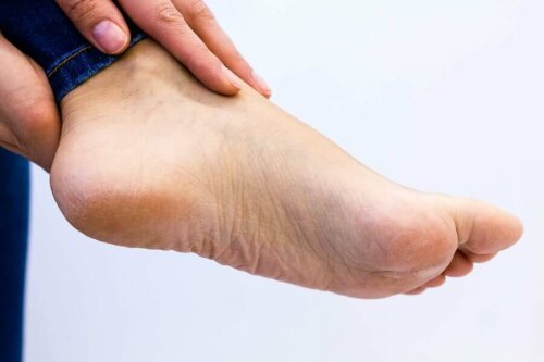 A person with yellow skin on the bottom of the feet.