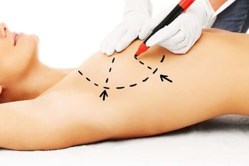 Myths about Breast Surgery