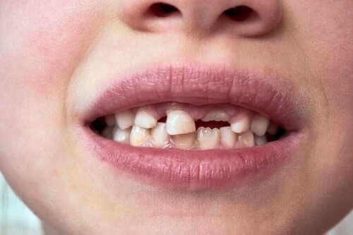 Baby teeth.
