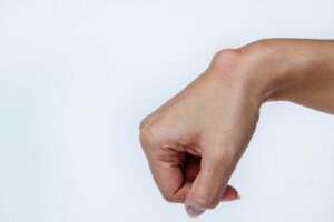 What’s the Difference Between a Cyst and a Tumor?