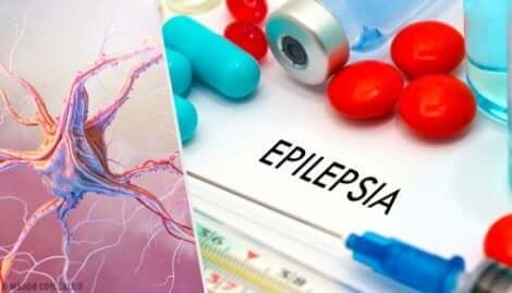 Gelastische Epilepsie