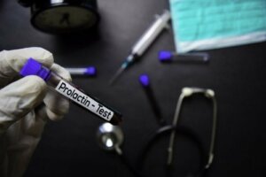 Normal Prolactin Levels and Why They Can Change