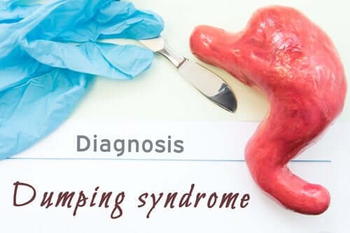 Dumping Syndrome: What Is It?