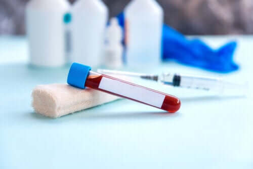 Erythrocyte Sedimentation Rate: What Does the Procedure Consist Of?