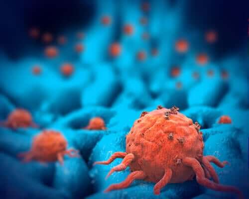 A few tumor cells.
