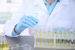 Urine Culture: What Is it and What’s it Used For?