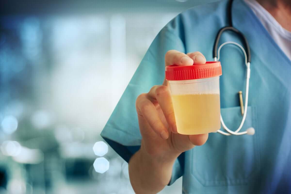 A medical professional holding a urine sample.