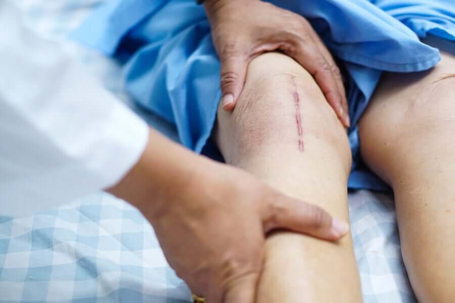 Arthroskopie - Knie mit Narbe