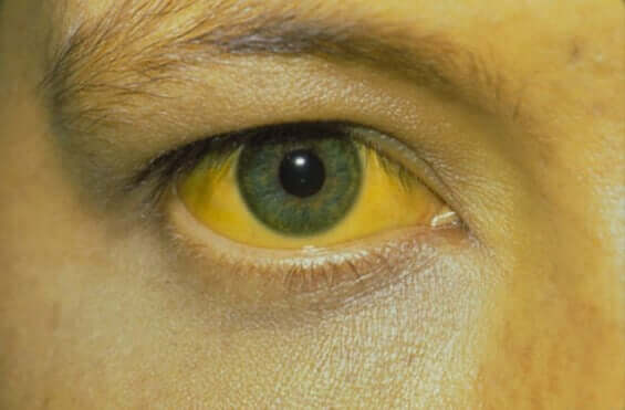 Een geel oog