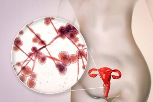 Ketoconazole for Fungal Infections: Indications and Contraindications