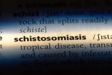 Schistosomiasis.