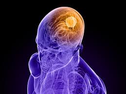 The human brain.
