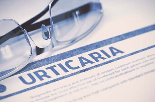 Cold Urticaria: Risk Factors and Prevention