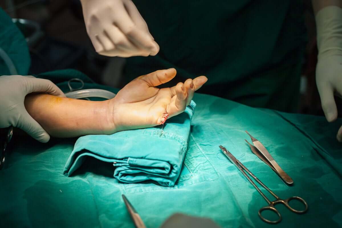 A hand surgery.