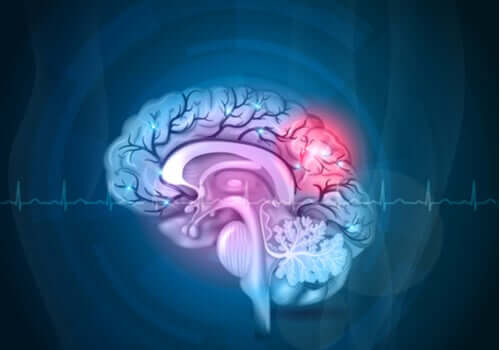 A lit brain.