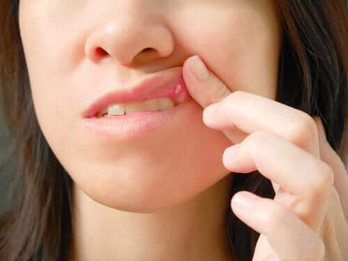 Causes of Mouth Sores and Treatments