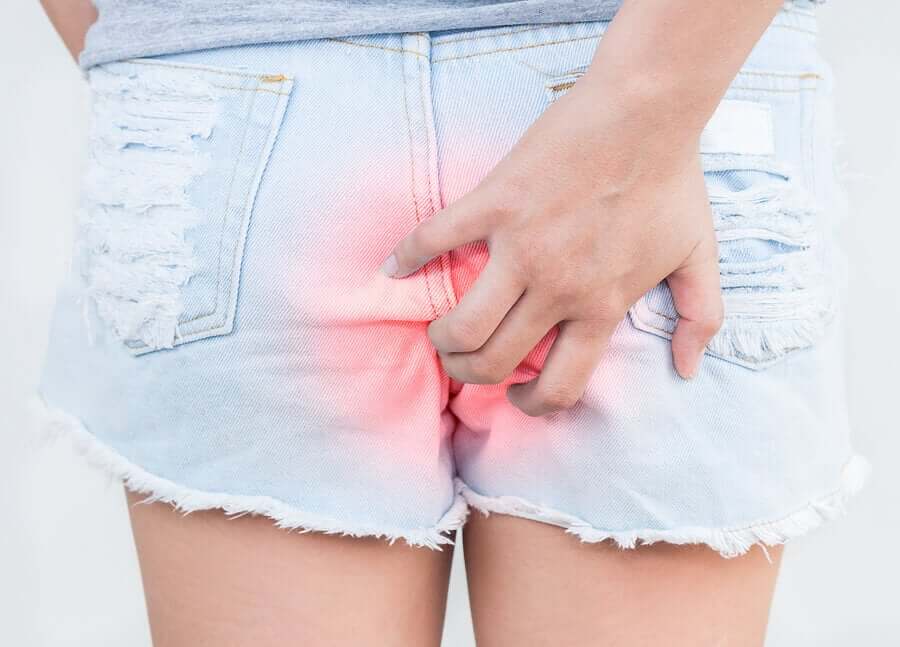 En kvinde med anal kløe