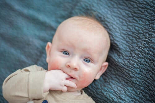 En baby med atopisk dermatitt i ansiktet.