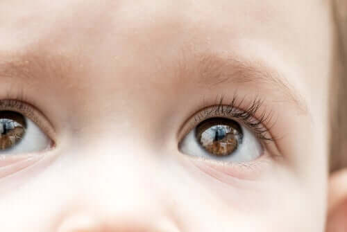 Childhood Glaucoma