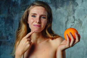 Citrus Allergy: Symptoms, Treatment, and Recommendations