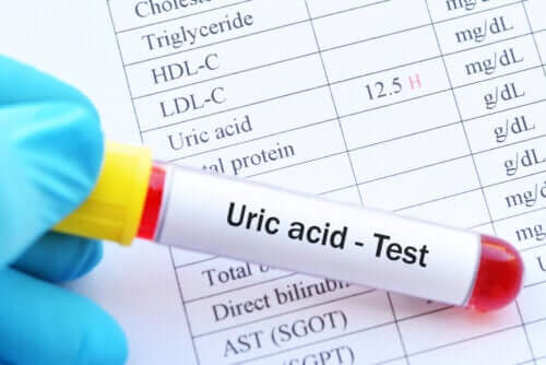 High Uric Acid: What are the Consequences?