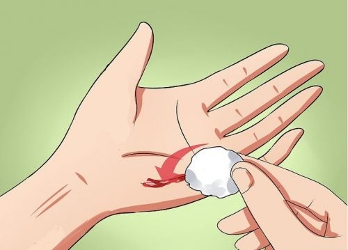 How to Prevent a Wound from Becoming Infected