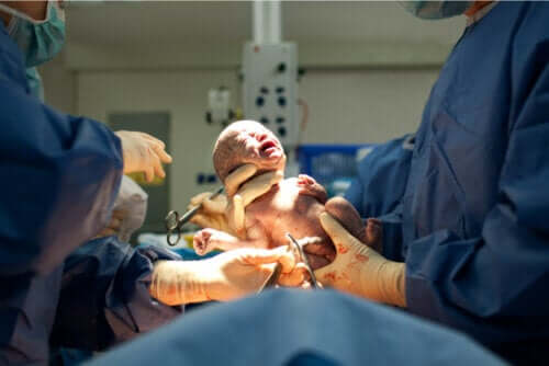 Natural Childbirth After C-Section: Is It a Good Idea?