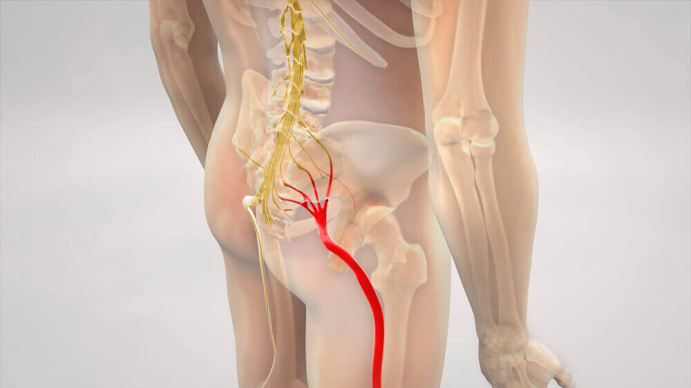 A digital illustration of the sciatic nerve.