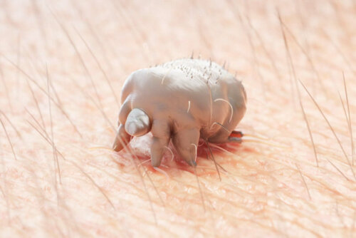The scabies parasite, Sarcoptes acaro