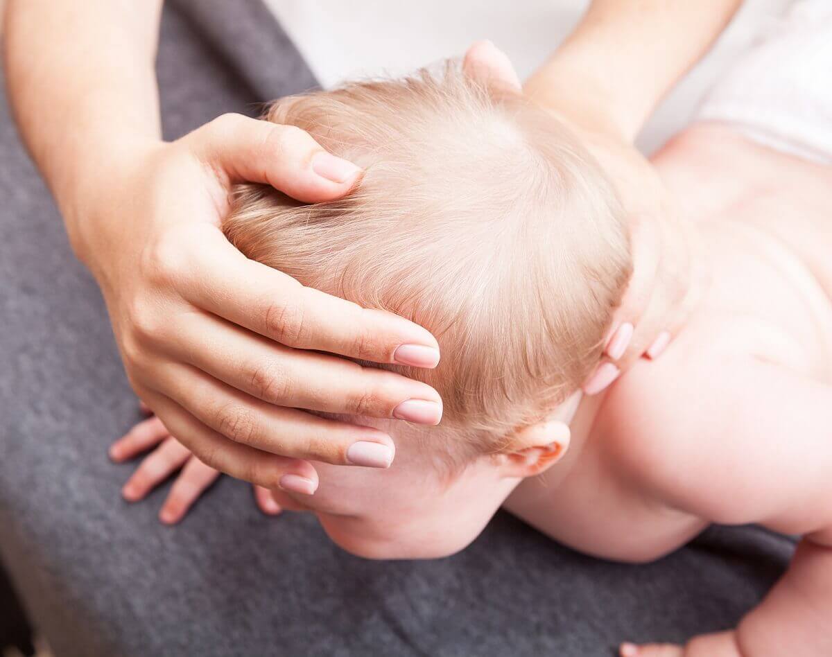 A baby with craniosynostosis.