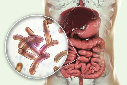 Treatment for Bacterial Overgrowth