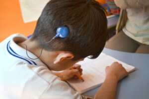 International Cochlear Implant Day: Everything You Need to Know