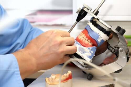 Dental Implant Prosthetics: What They Are and the Different Types Available